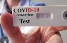 COVID. Test salivari, diagnosi precoce, terapia domiciliare