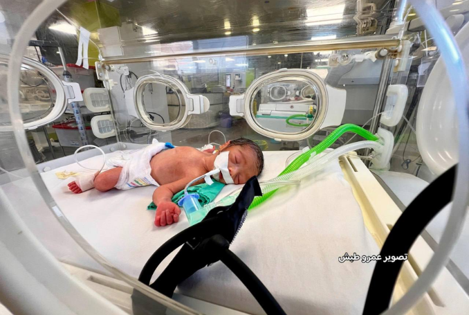 I generatori degli ospedali di Gaza si guastano mentre Israele limita petrolio, carburante e pezzi di ricambio
